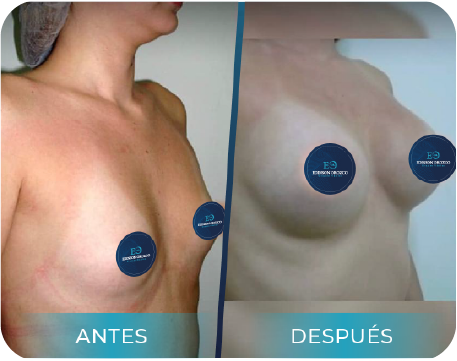 3Recurso 1